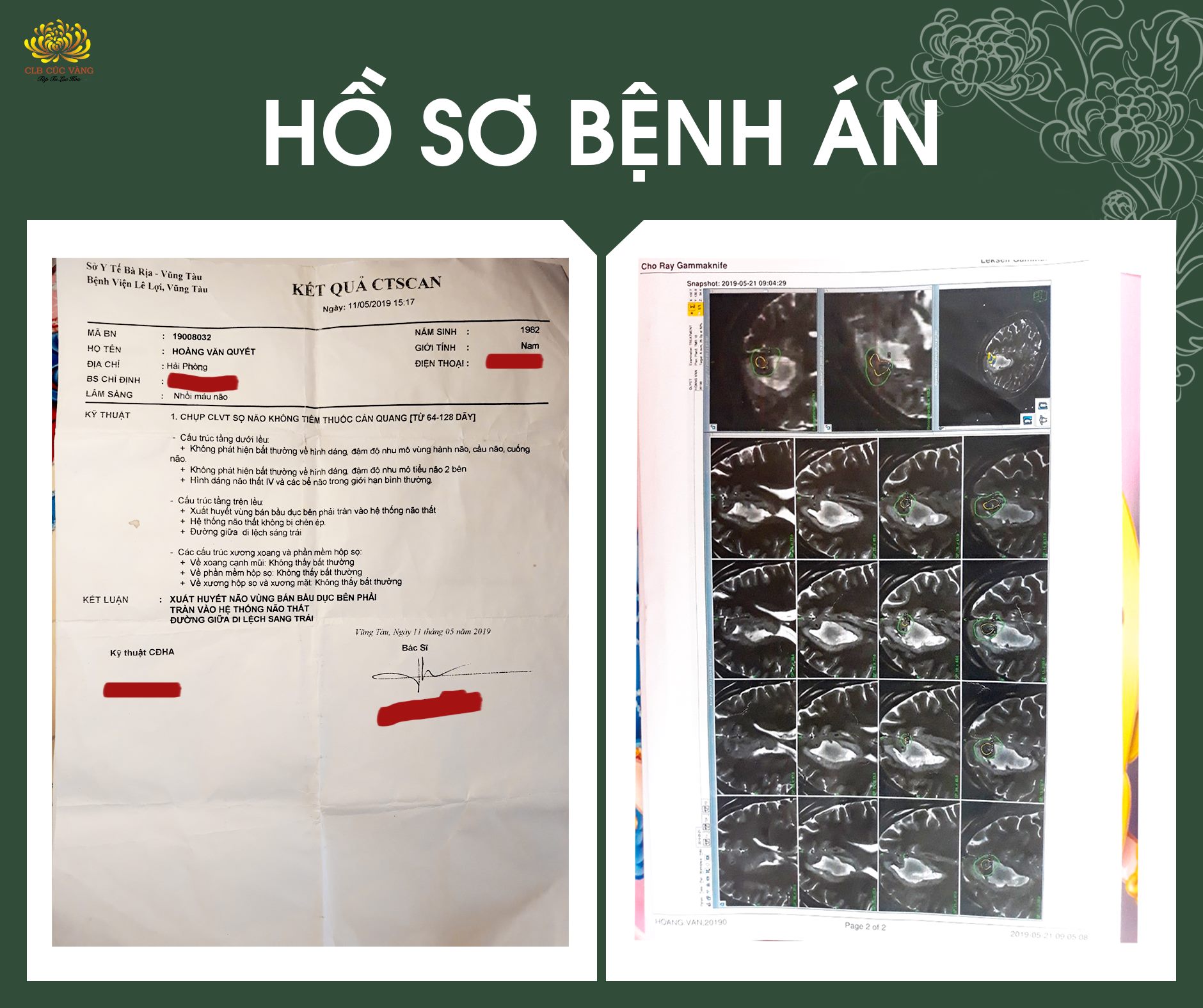 Một số hình ảnh bệnh án của anh Hoàng Văn Quyết tại Bệnh viện Vũng Tàu và Bệnh viện Chợ Rẫy - TP. HCM